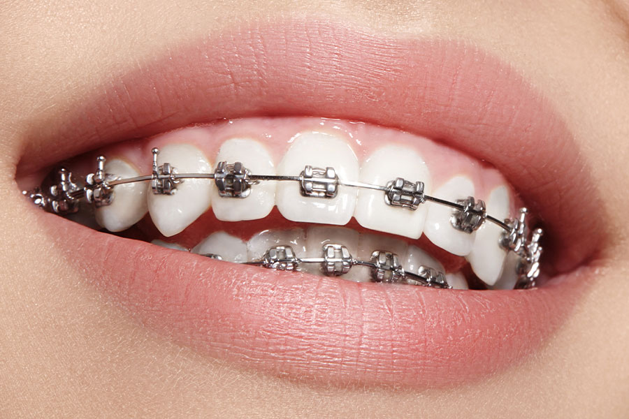 dokter gigi terdekat - behel gigi