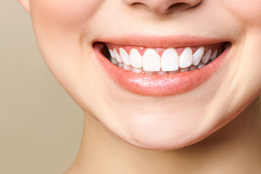 dokter gigi terdekat - bleaching gigi