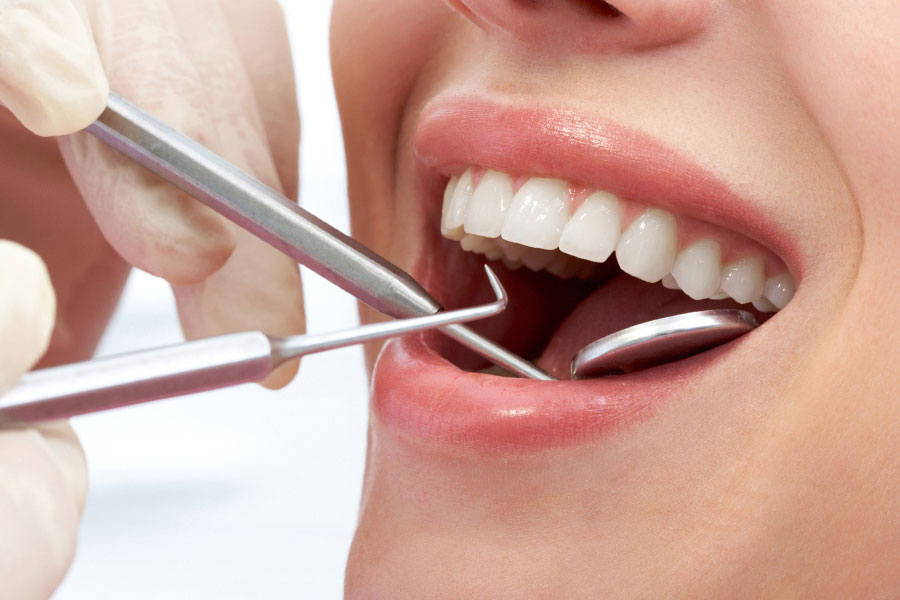 dokter gigi terdekat - scaling gigi